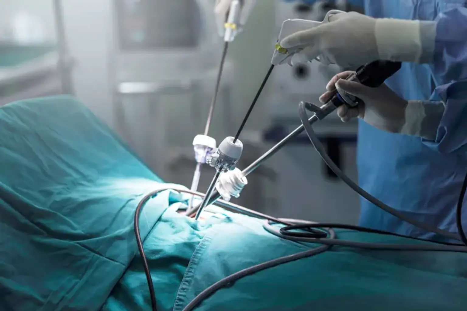 Advanced Laparoscopic & Robotic Surgery